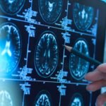 "Strolling: An Essential Factor in Reducing Alzheimer's Risk Among Black Communities"