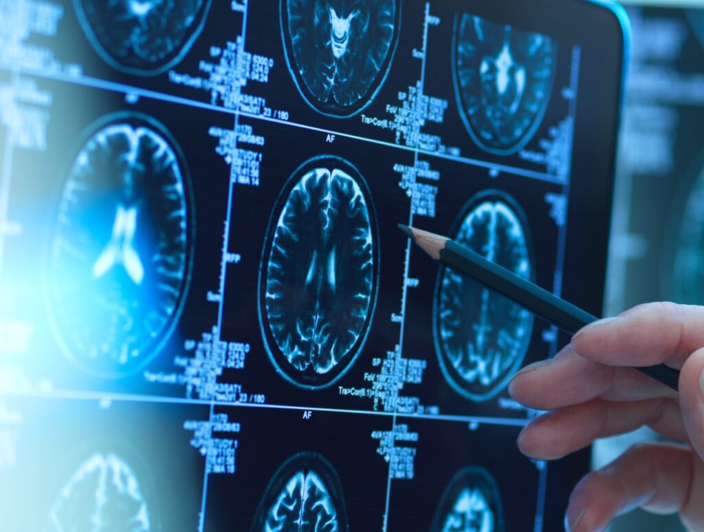 "Strolling: An Essential Factor in Reducing Alzheimer's Risk Among Black Communities"